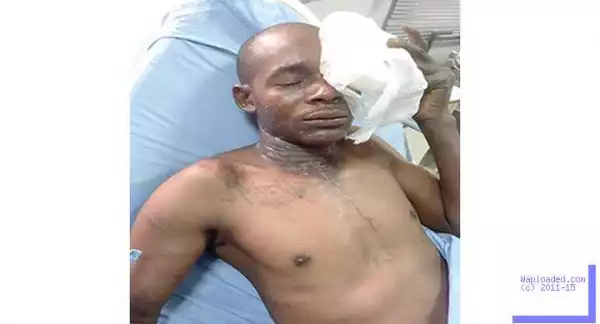 Hoodlums Bathe Task Force Official With Acid In Lagos (Photo)